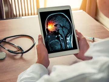 Meningitis Meningitis