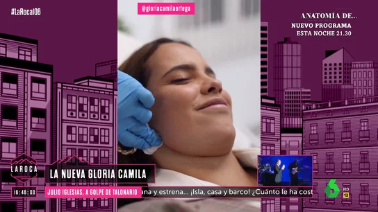 Gloria Camila se somete a una operación de estética Gloria Camila se somete a una operación de estética