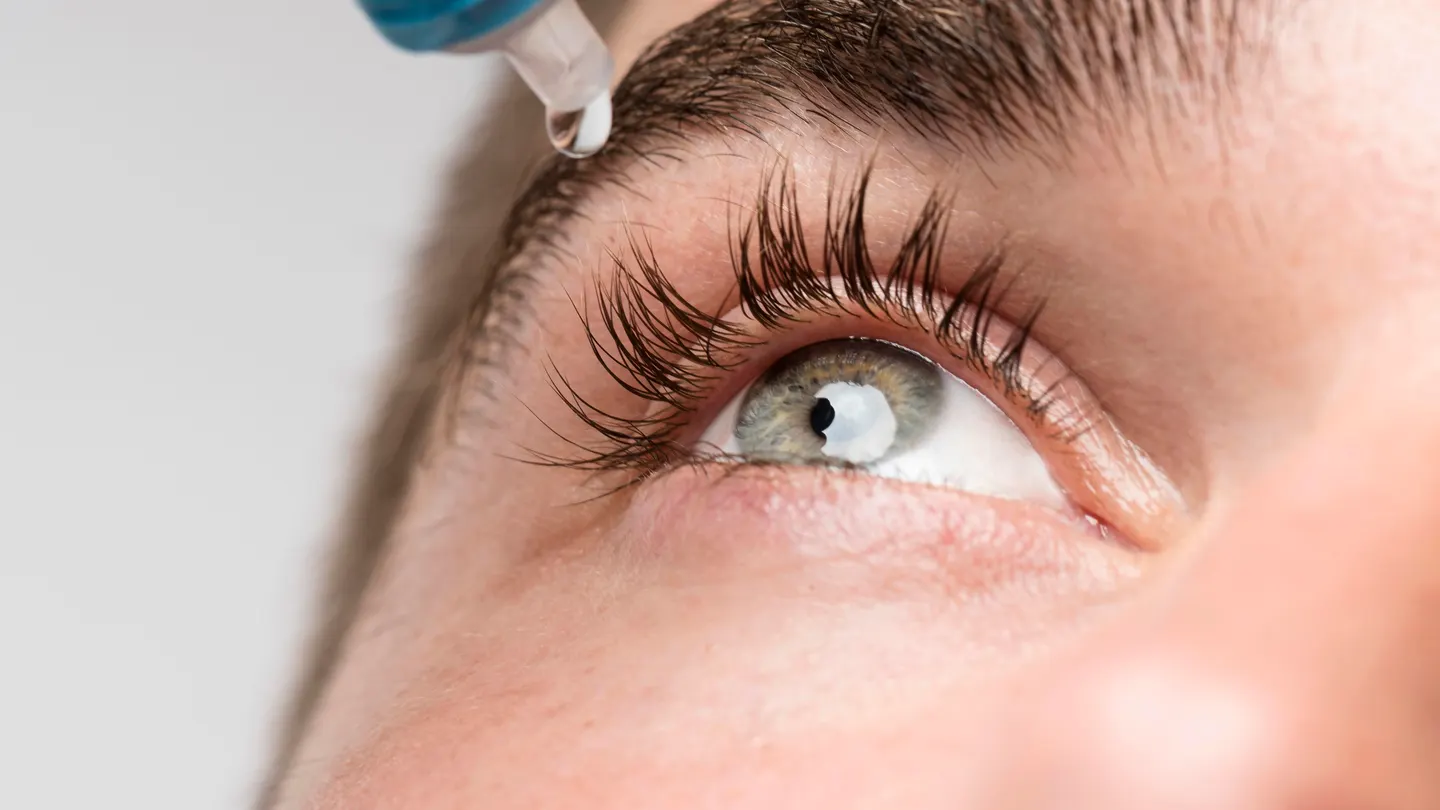 Un persona echándose gotas en los ojos. Un persona echándose gotas en los ojos.