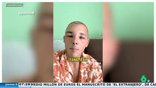 Un joven se viraliza tras mostrar la hinchazón de su cara tras un implante capilar: "Quillo parezco Quasimodo" Un joven se viraliza tras mostrar la hinchazón de su cara tras un implante capilar: "Quillo parezco Quasimodo"