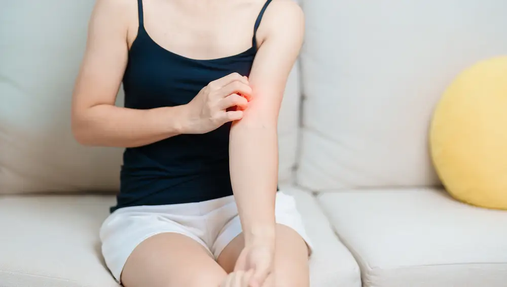 Picor en la piel Picor en la piel