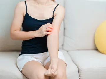 Picor en la piel Picor en la piel