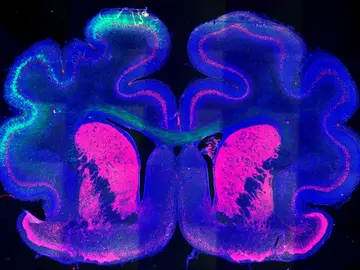 Este mecanismo determina la formacion de pliegues en la corteza cerebral Este mecanismo determina la formacion de pliegues en la corteza cerebral