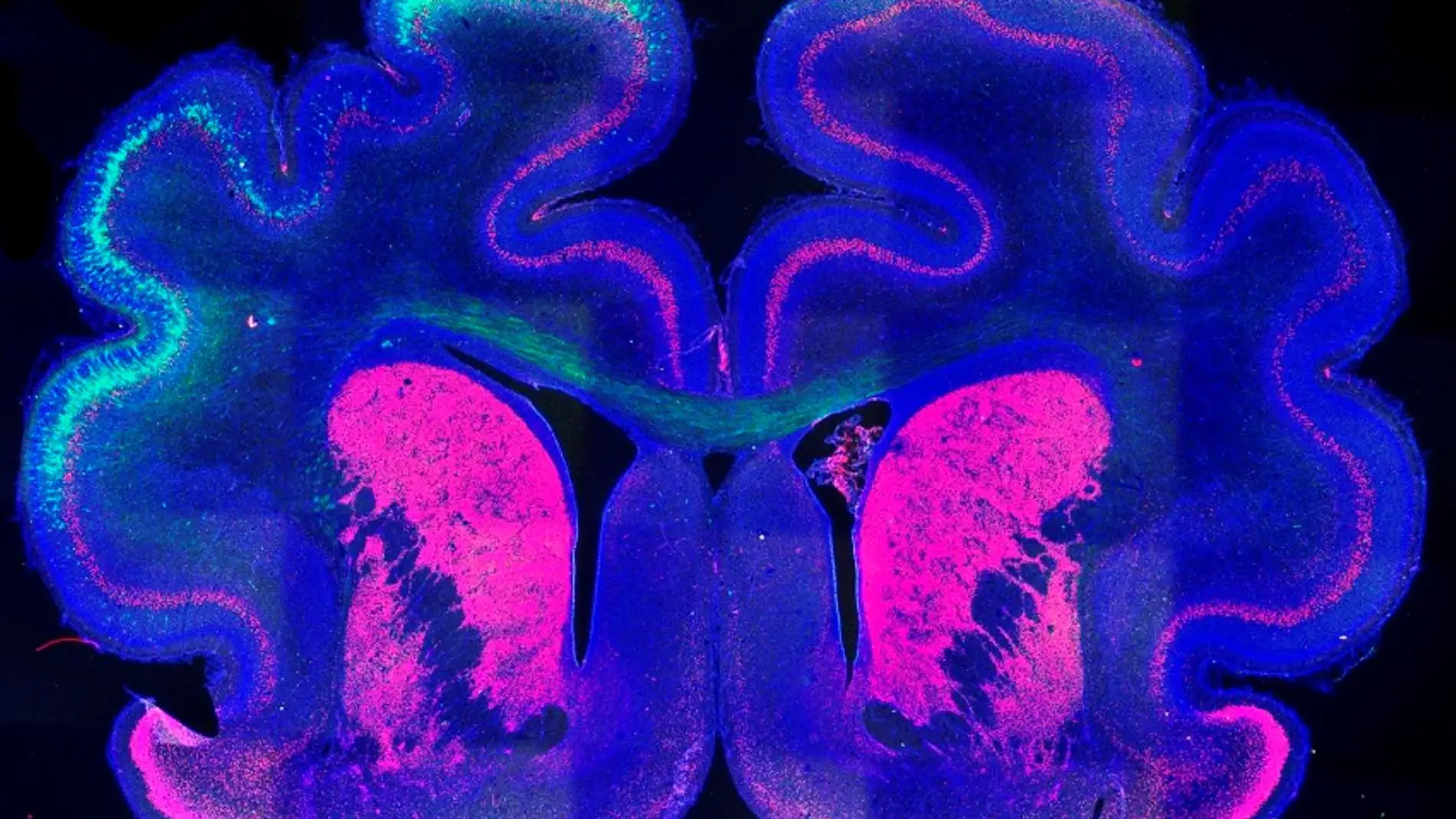 Este mecanismo determina la formacion de pliegues en la corteza cerebral Este mecanismo determina la formacion de pliegues en la corteza cerebral