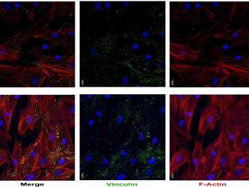 Fotomicrografías del efecto del péptido intestinal vasoactivo (VIP) sobre el citoesqueleto y osteoblastos