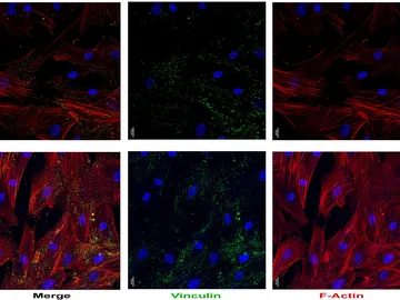 Fotomicrografías del efecto del péptido intestinal vasoactivo (VIP) sobre el citoesqueleto y osteoblastos Fotomicrografías del efecto del péptido intestinal vasoactivo (VIP) sobre el citoesqueleto y osteoblastos