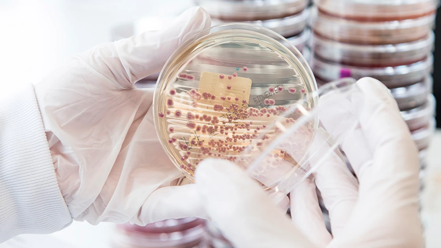 Detectan un nivel "muy preocupante" de niños portadores de bacterias resistentes a los antibióticos en África subsahariana Detectan un nivel "muy preocupante" de niños portadores de bacterias resistentes a los antibióticos en África subsahariana