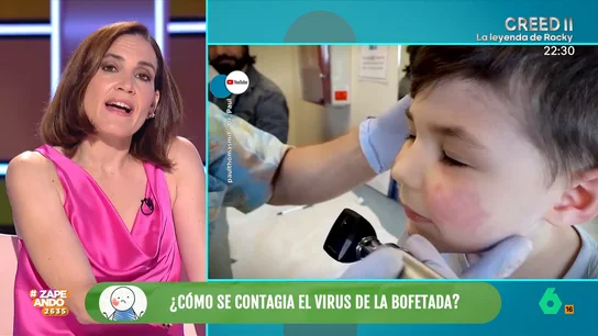 Boticaria García explica qué es y cómo evoluciona el virus de la bofetada, habitual entre los niños Boticaria García da información sobre esta enfermedad infantil