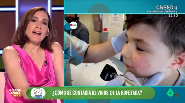 Boticaria García explica qué es y cómo evoluciona el virus de la bofetada, habitual entre los niños