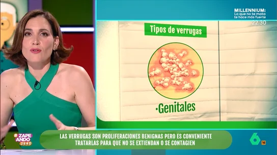 Boticaria García enseña a los zapeadores a diferenciar los tipos de verrugas Boticaria García enseña a los zapeadores a diferenciar los tipos de verrugas