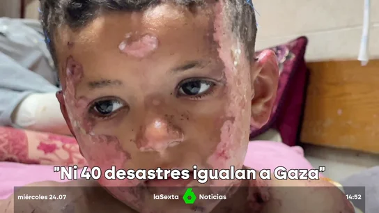 denuncia cirujano Gaza denuncia cirujano Gaza