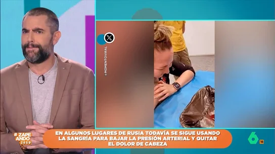 Los zapeadores alucinan con la técnica utilizada en Rusia para aliviar el dolor de cabeza: abrir un boquete en la frente Hay técnicas milenarias que se siguen utilizando en nuestros días a pesar de que pueden parecer cuestionables. Una de ellas es la trepanación que puede ayudar para aliviar la presión arterial.