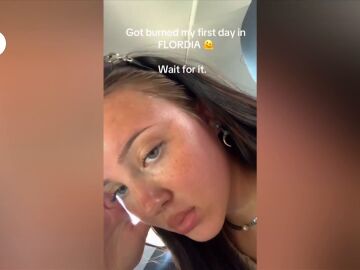 Una joven se pasa tomando el sol y termina con la frente abollada: "Por menos hay sitios que se declaran zona catastrófica"
