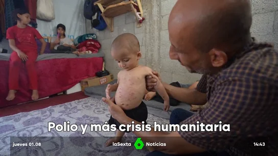 El Ministerio de Sanidad de Gaza declara la Franja como "zona epidémica de polio" El Ministerio de Sanidad de Gaza declara la Franja como "zona epidémica de polio"