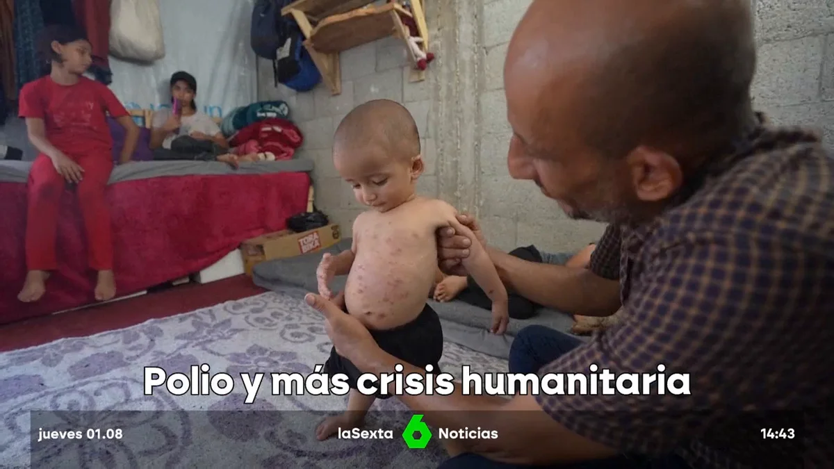 A polio outbreak ravages the Gaza Strip, the new threat that adds to the Israeli massacre A polio outbreak ravages the Gaza Strip, the new threat that adds to the Israeli massacre