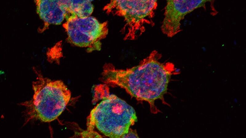 Descubren la causa de la reaparición del tumor linfático y su resistencia terapéutica