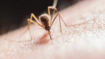 Picadura de mosquito