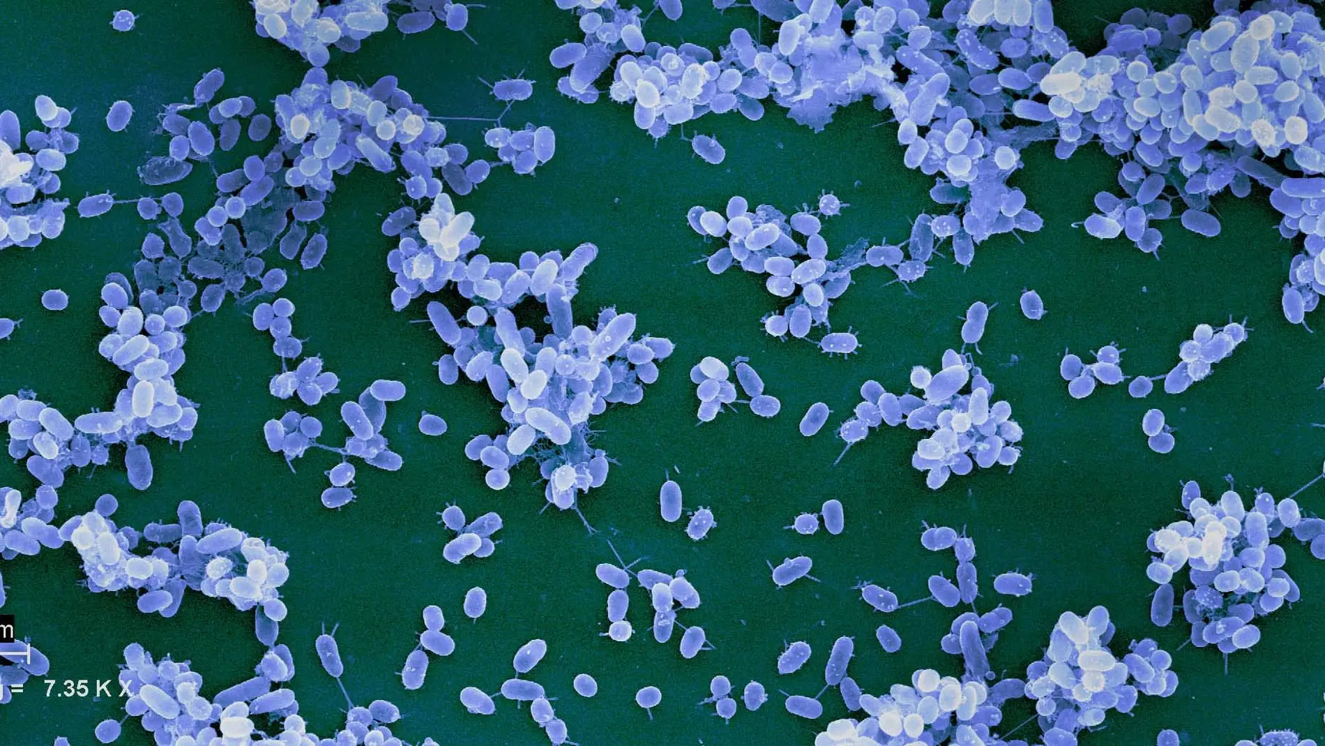 Imagen de microscopía de bacterias Imagen de microscopía de bacterias