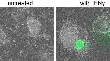 Imágenes de microscopía de células madre