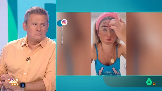 Quique Peinado alucina con el asqueroso producto que usa una influencer brasileña en su rutina de belleza La joven muestra a través de un vídeo, publicado en su Instagram, el 'exclusivo' producto que utilizada para hacerse una mascarilla facial, no apto para personas escrupulosas.