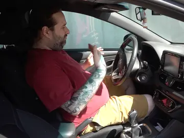 Conductor que se ha quemado con el volante Conductor que se ha quemado con el volante