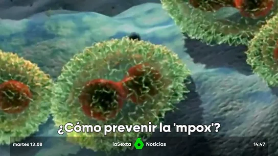 Preocupación en la OMS por el aumento de casos "sin precedentes" de la viruela del mono Preocupación en la OMS por el aumento de casos "sin precedentes" de la viruela del mono