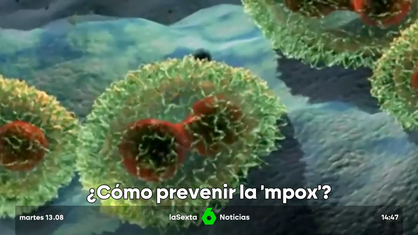 Preocupación en la OMS por el aumento de casos "sin precedentes" de la viruela del mono Preocupación en la OMS por el aumento de casos "sin precedentes" de la viruela del mono