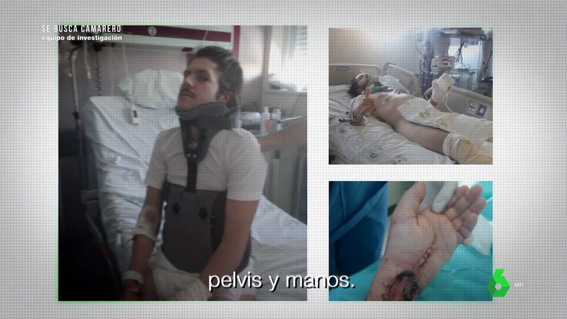 Un repartidor que estuvo al borde de la muerte y con más de 40 fracturas por un accidente laboral: "No he recibido ninguna llamada de la empresa ni de mi jefe"