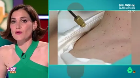 "Son tan feas como comunes": Boticaria García expone por qué aparecen las verrugas La farmacéutica indicó que estas lesiones son una de las principales causas de las visitas al dermatólogo al llegar la mediana edad.