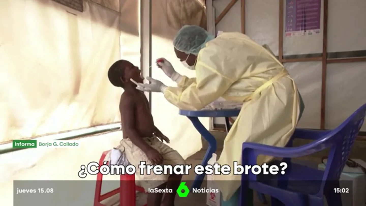 Así se ha desatado el nuevo brote de viruela del mono: este es el plan de la OMS para frenarlo Así se ha desatado el nuevo brote de viruela del mono: este es el plan de la OMS para frenarlo