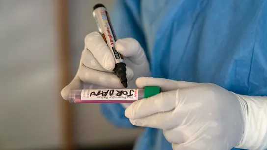 Un sanitario etiqueta una muestra de mpox tomada de un paciente. Un sanitario etiqueta una muestra de mpox tomada de un paciente.
