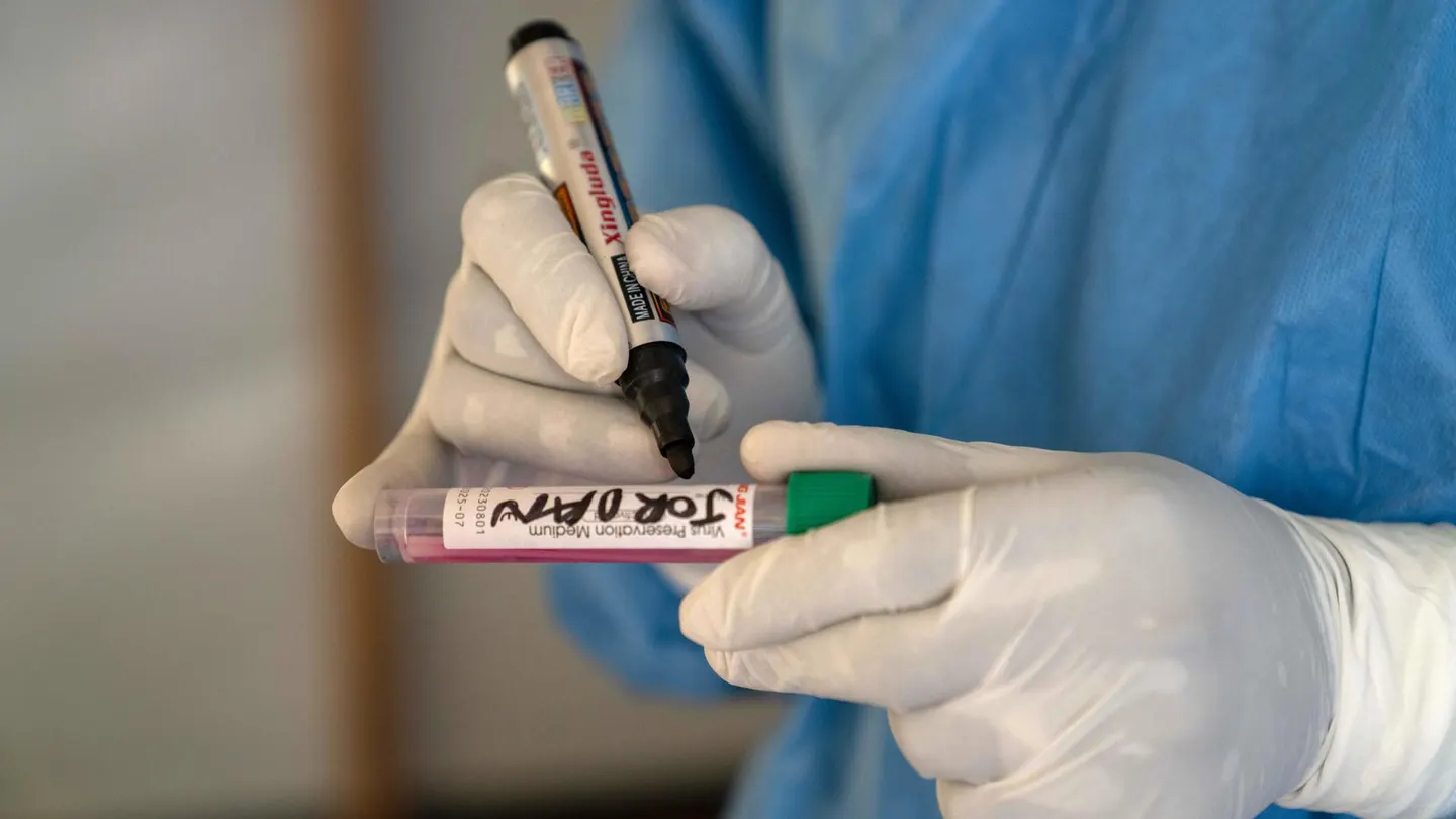 Un sanitario etiqueta una muestra de mpox tomada de un paciente. Un sanitario etiqueta una muestra de mpox tomada de un paciente.