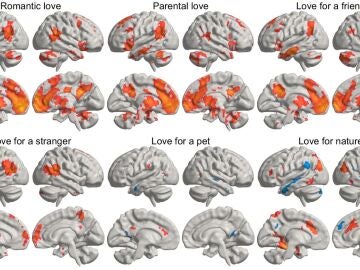 Diferentes tipos de amor en el cerebro