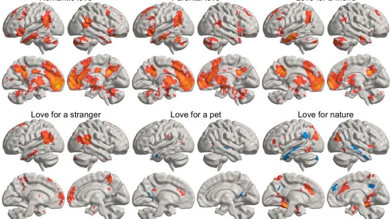 Encuentran dónde vive el amor en el cerebro y cómo se activa 
