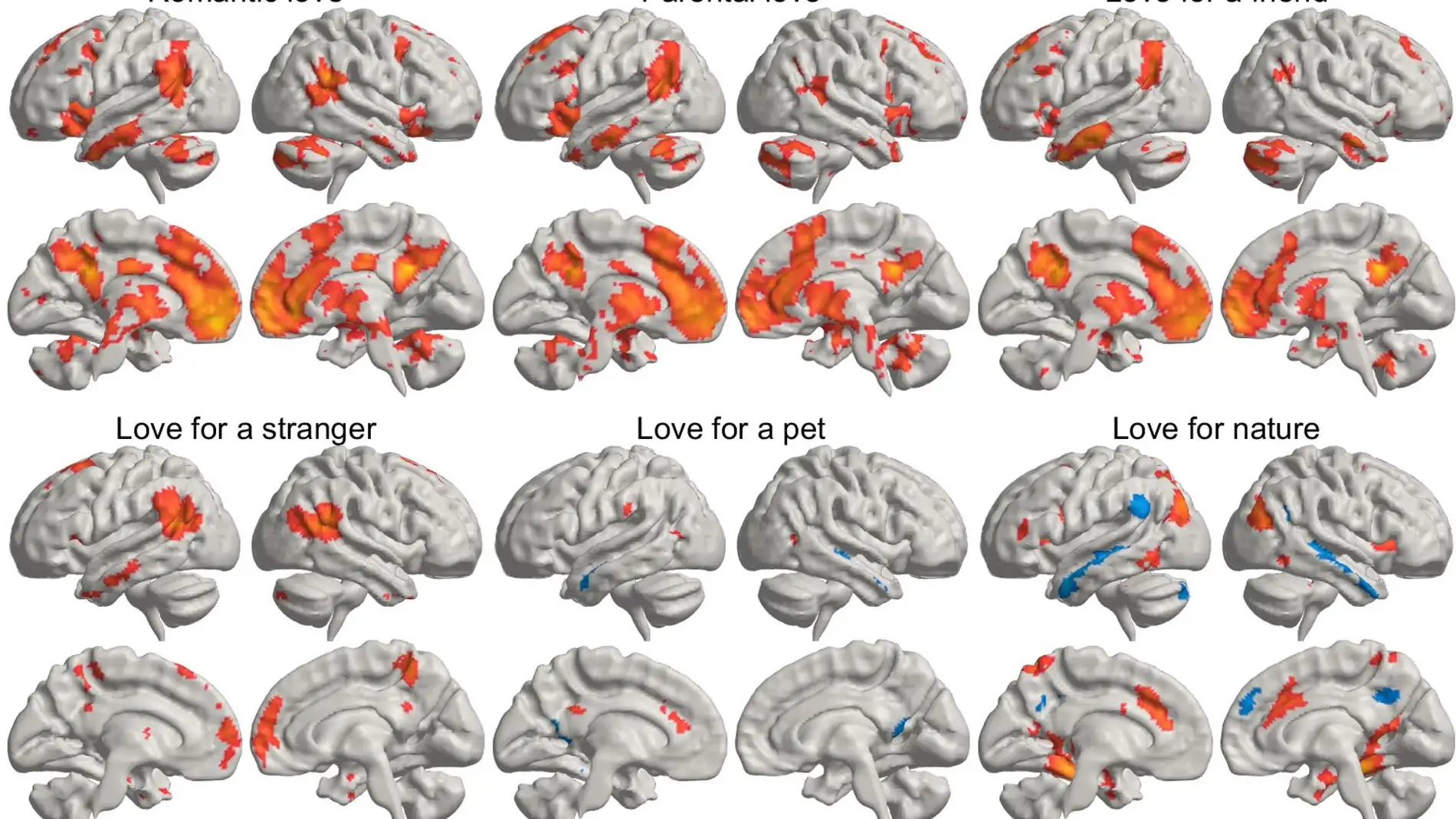 Diferentes tipos de amor en el cerebro Diferentes tipos de amor en el cerebro