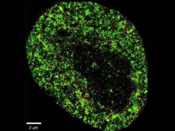 Imagen microscópica de una célula cancerosa 