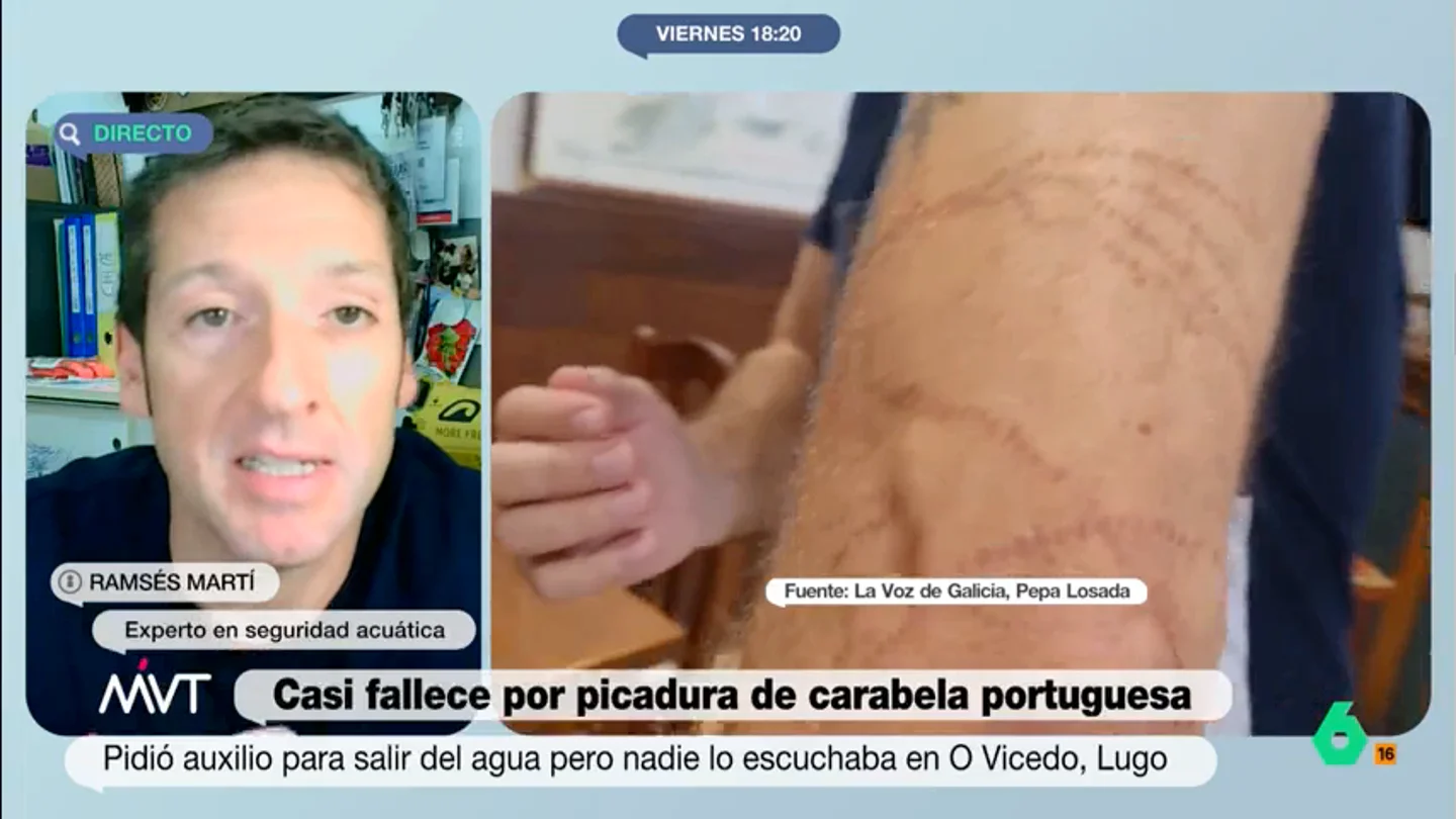 Un experto en seguridad acuática explica qué debes hacer si te pica una carabela portuguesa: "Produce un dolor que paraliza" Ramsés Martí expone que los tentáculos de este animal pueden llegar a medir hasta 30 metros lo que hace que sean capaces de entrar en contacto con una gran superficie de piel.