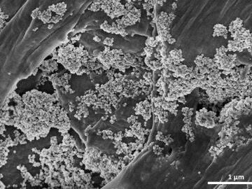 Imagen captada por microscopía electrónica de barrido donde se ve las nanoflores de óxido de hierro sobre microplásticos