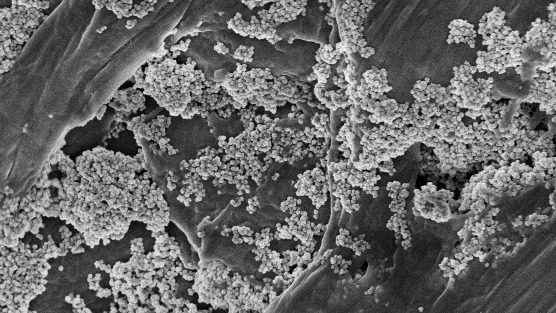 Imagen captada por microscopía electrónica de barrido donde se ve las nanoflores de óxido de hierro sobre microplásticos Imagen captada por microscopía electrónica de barrido donde se ve las nanoflores de óxido de hierro sobre microplásticos