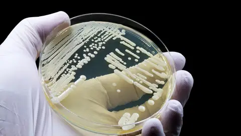 Hongo Candida auris Hongo Candida auris