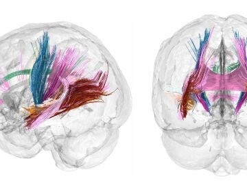 Los cambios en la materia gris y blanca del cerebro a lo largo de la gestación fueron visibles en las imágenes