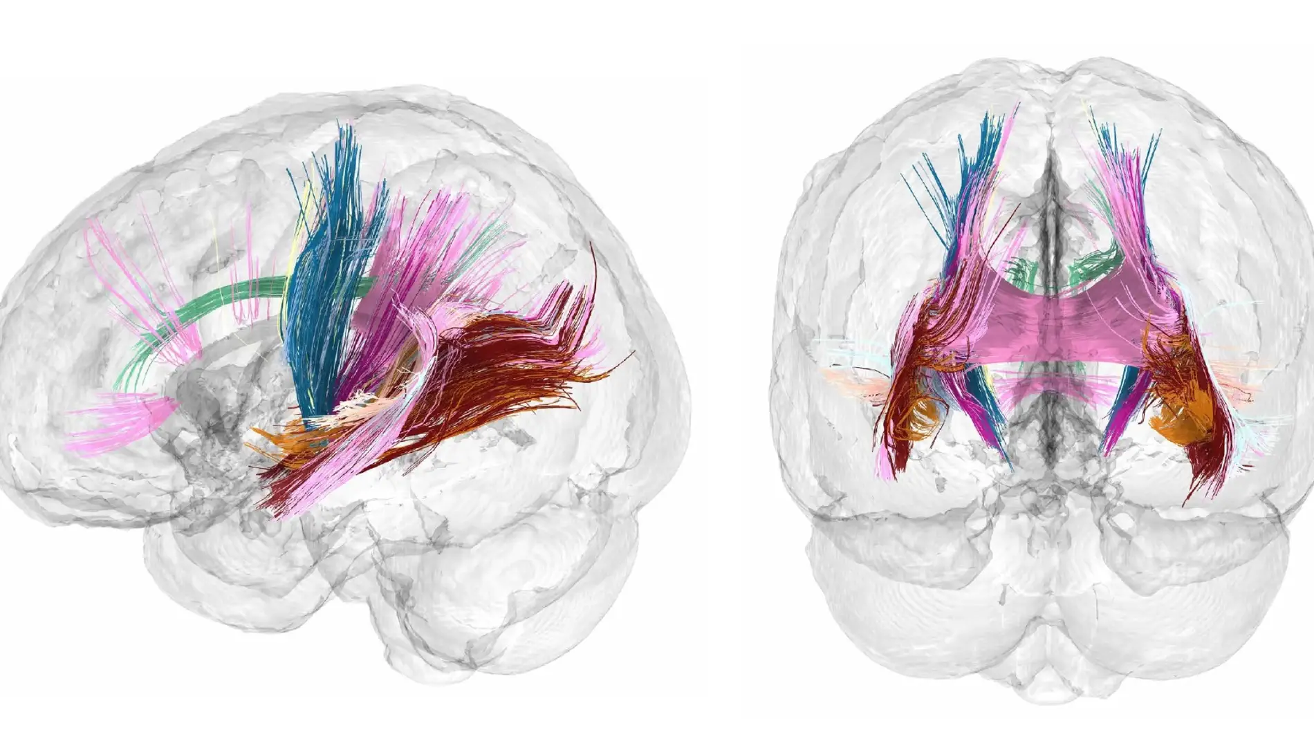 Los cambios en la materia gris y blanca del cerebro a lo largo de la gestación fueron visibles en las imágenes Los cambios en la materia gris y blanca del cerebro a lo largo de la gestación fueron visibles en las imágenes