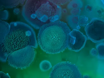 Hongo Aspergillus fumigatus Hongo Aspergillus fumigatus