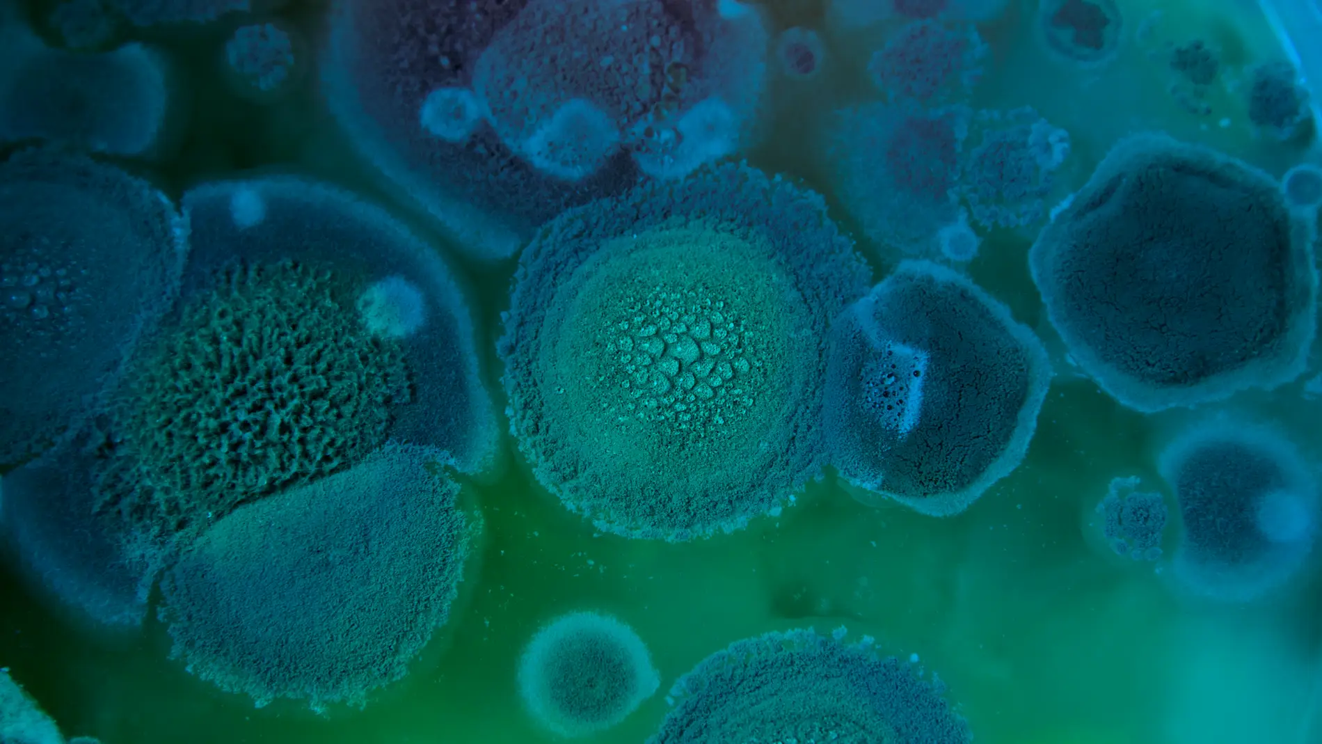 Hongo Aspergillus fumigatus Hongo Aspergillus fumigatus