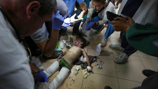 Los médicos atienden a un niño herido en un bombardeo israelí al campo de refugiados de Nuseirat Los médicos atienden a un niño herido en un bombardeo israelí al campo de refugiados de Nuseirat
