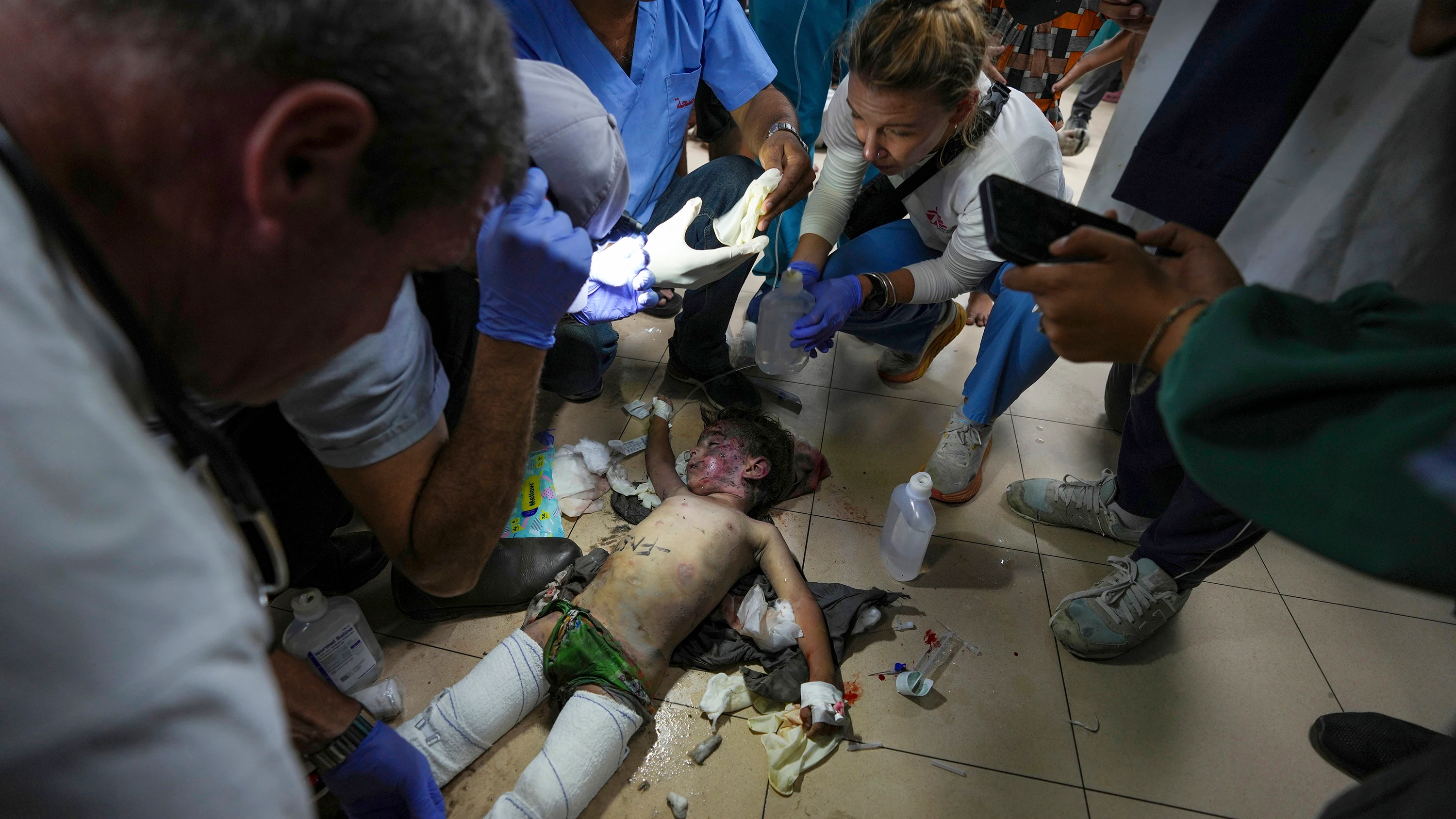 Los médicos atienden a un niño herido en un bombardeo israelí al campo de refugiados de Nuseirat