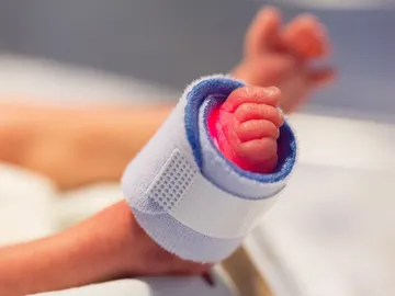 Pie de un bebé prematuro Pie de un bebé prematuro