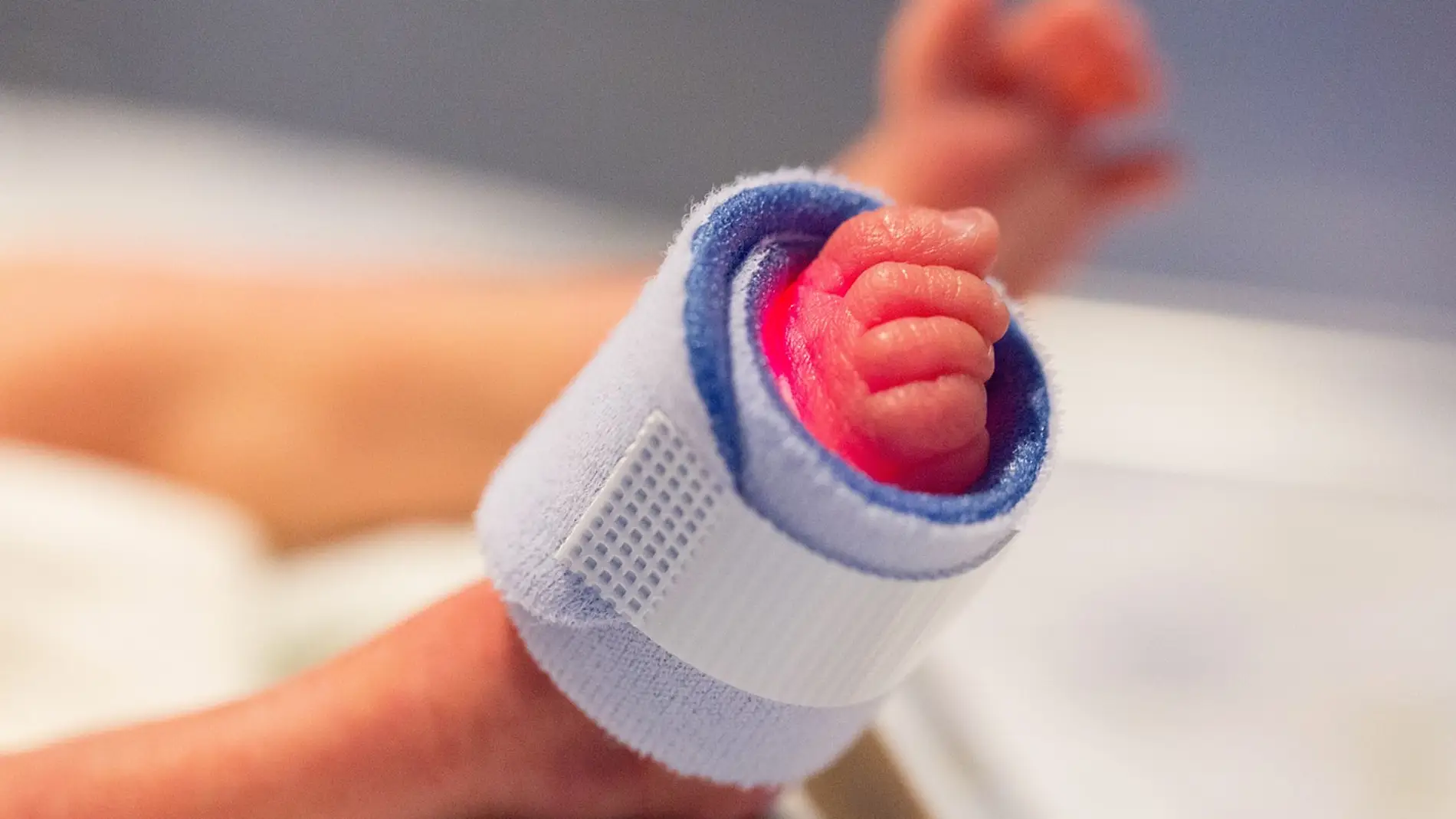 Pie de un bebé prematuro Pie de un bebé prematuro
