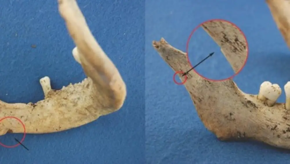 Mandíbula de James FitzJames Mandíbula de James FitzJames