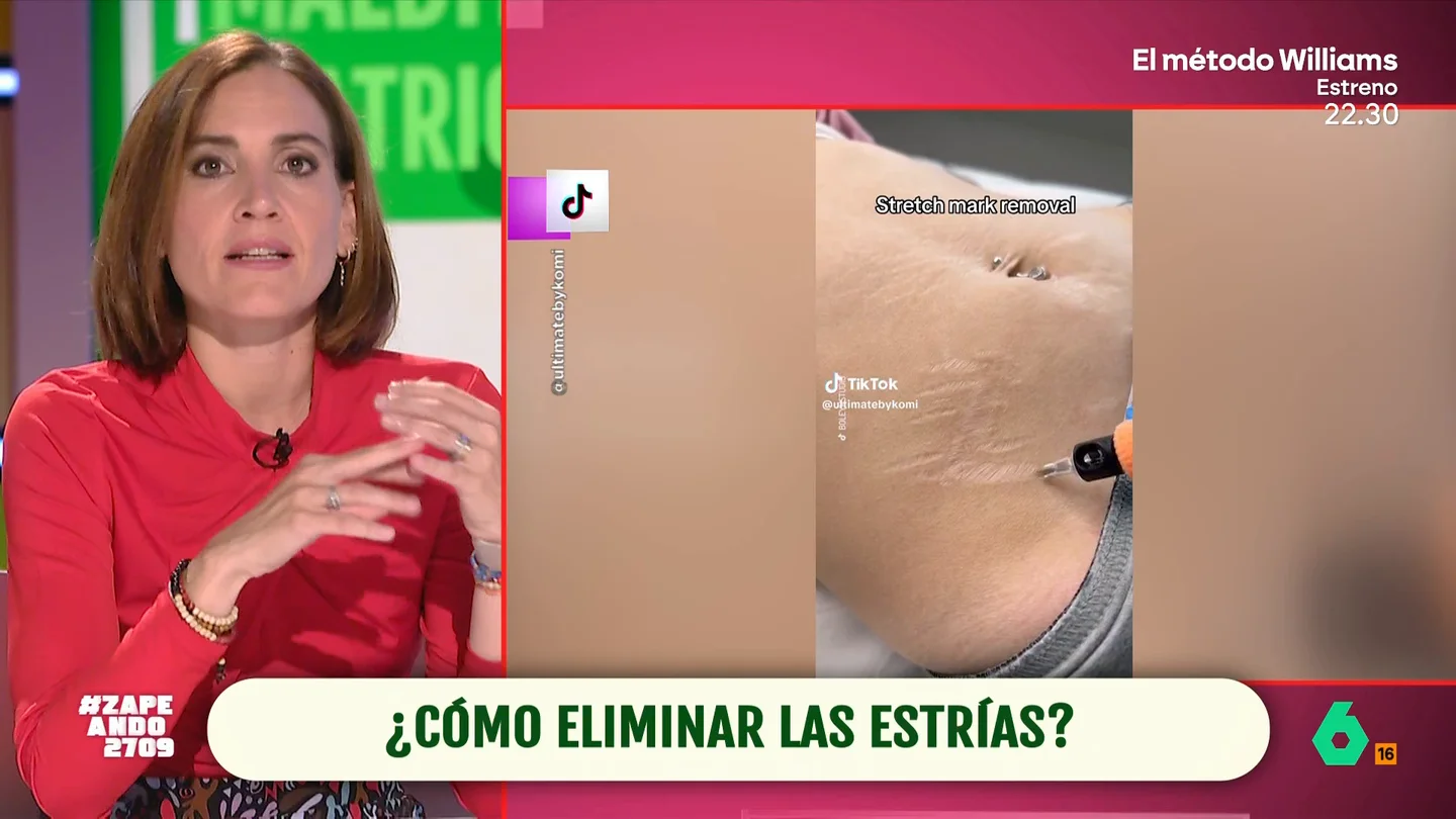 ¿Cómo se eliminan las estrías? Boticaria García te lo cuenta en Zapeando ¿Cómo se eliminan las estrías? Boticaria García te lo cuenta en Zapeando